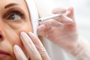 Benefícios e cuidados do preenchimento facial