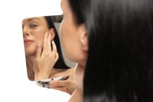 Melasma, você sabe o que é?